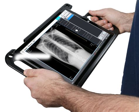 MinXray Portable X-ray System with Digital X-ray / DR Panel