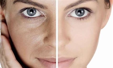 Natural anti aging and wrinkle cream - 7eNEWS