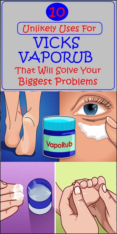 10 Unlikely Uses For Vicks VapoRub That Will Solve Your Biggest Problems - Theraphy 2