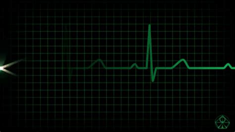 Best analog ecg animation hd GIF on GIFER - by Burilar