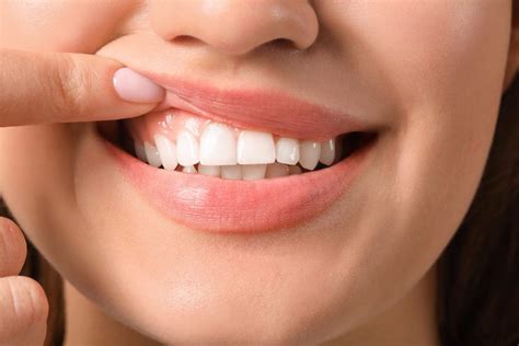 Understanding Gum Health And What Their Color Tells You | Smile Solutions | Garden City, NY