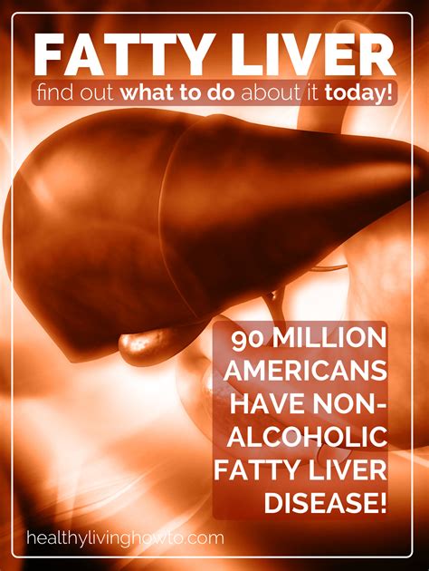 Liver Detox Cleanse, Detox Your Liver, Detox Diet Plan, Fatty Liver Diet, Healthy Liver, Liver ...