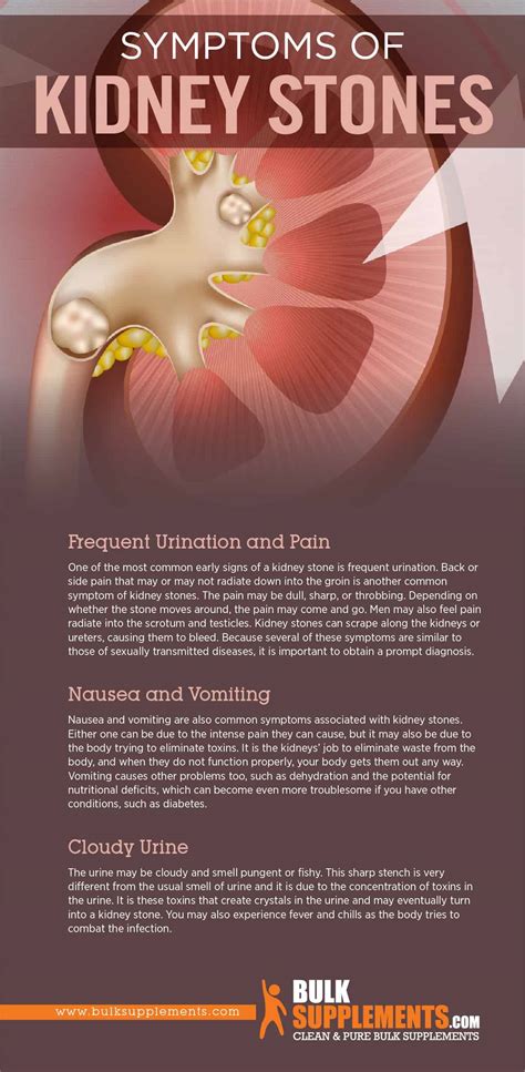 Kidney Stones: Symptoms, Causes & Treatment by James Denlinger