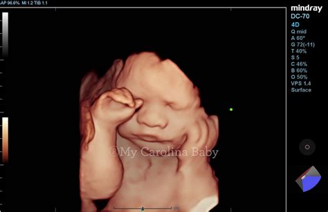 Premier Combo Ultrasound Package | My Carolina Baby