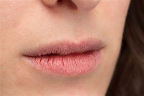 Dry Mouth Lips Sticking To Teeth | Sitelip.org