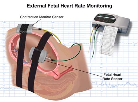 Review Article: Non-Invasive Fetal Heart Rate Monitoring Techniques