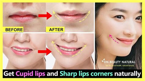Get Cupid Lips & Sharp Lips Corners | Lift downturned mouth corners | Fix uneven lips corners ...