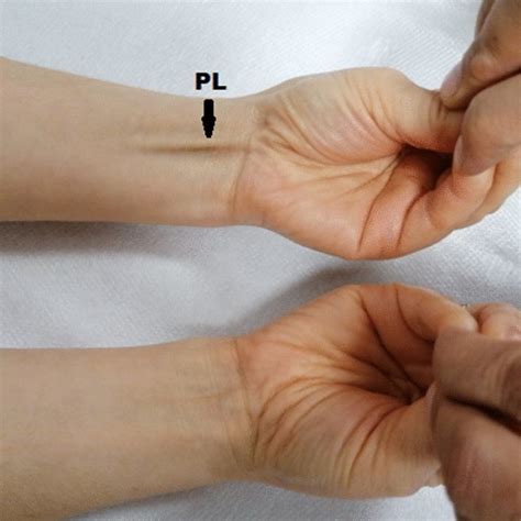 a Schaeffer test for demonstrating the palmaris longus tendon. b ...