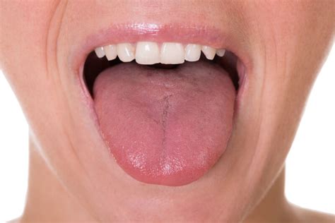 Tongue Swelling: Allergies Or Underlying Illness?