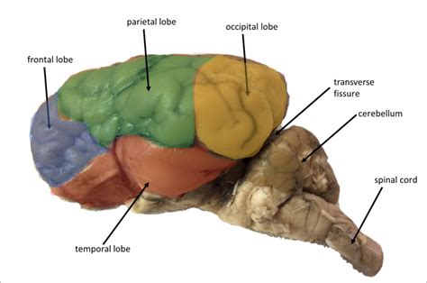 Sheep brain lobes Diagram | Quizlet