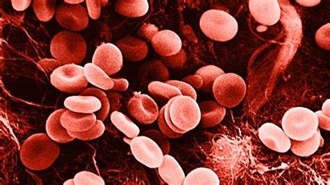 Red blood cell disorders: Types, causes, and symptoms