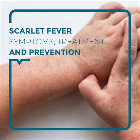 SCARLET FEVER - Alegria Medical Centre