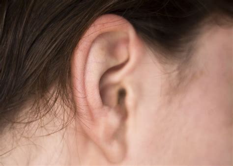 How to Treat an Itchy Ear Canal Itchy Ears Remedies, Earache Remedies, Health Remedies, Natural ...