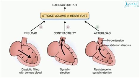 afterload (English) - Medical terminology for medical students - - YouTube