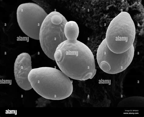 Saccharomyces Cerevisiae Electron Microscope