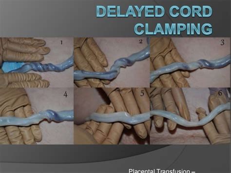 Delayed cord clamping