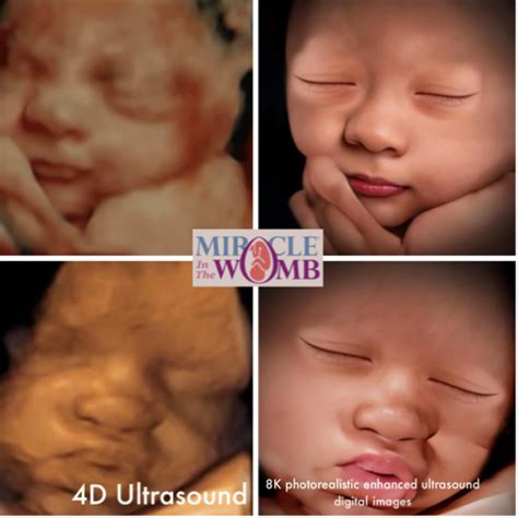 4D 3D Ultrasound – drawspaces.com