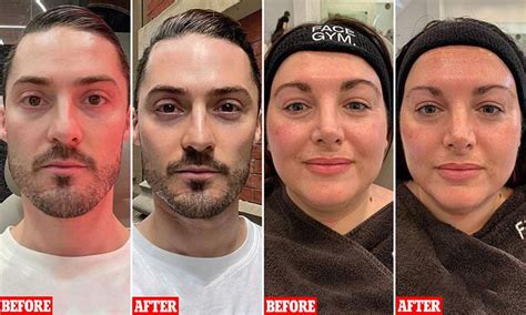 How beauty fans de-puffed their faces in 35 minutes with massage ...