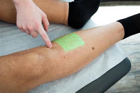 What Your Blue, Green, or Purple Veins Are Telling You | Metro Vein Centers