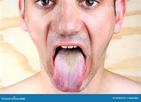 Disease Tongue Stock Photography | CartoonDealer.com #37501010