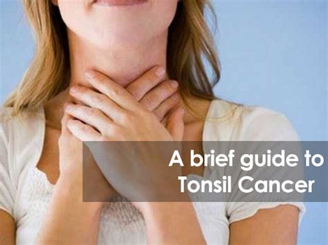 A Brief guide to Tonsil Cancer | Cancer Healer Center