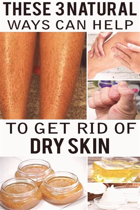 How to Remove Dry Skin on Legs and Hands at Home Normally dry skin ...
