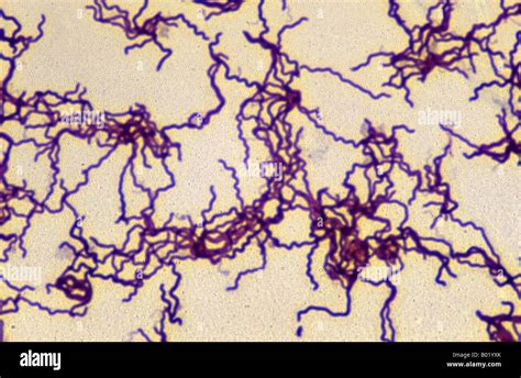 Treponema pallidum bacterium Stock Photo - Alamy