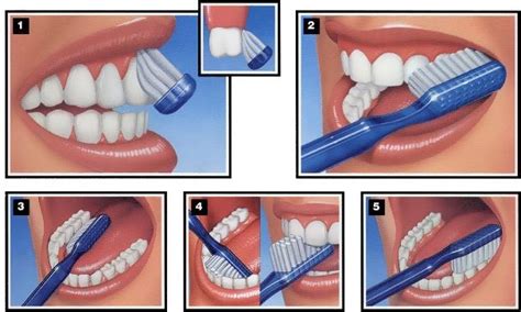 Flossing Technique