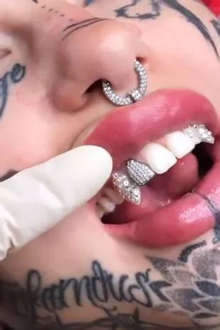 Sharpened Teeth Body Modification