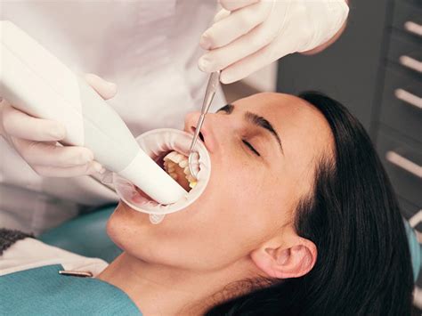 Teeth Cleaning Bydental Clinic Singapore Services - Health Engagement