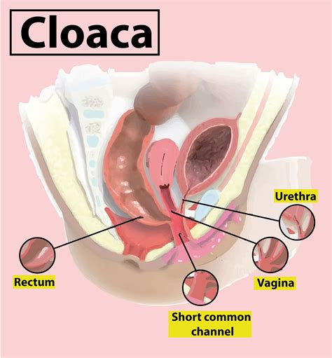 Cloaca is(a)Common aperture for digestive and urinary systems(b)Common ...