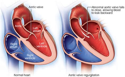 Aorta O - 63 фото