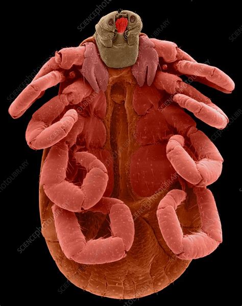 American dog tick (Dermacentor variabilis), SEM - Stock Image - C032/1573 - Science Photo Library