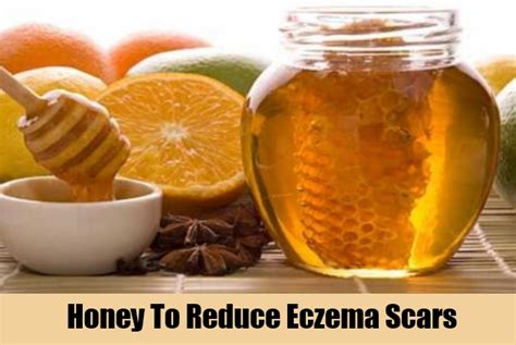 6 Eczema Scars Home Remedies, Natural Treatments And Cure | AyurvedicCure.com