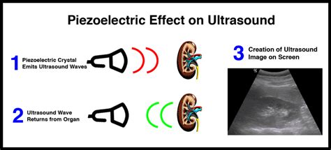 Learning Ultrasound Physics, Doppler, and Artifacts doesn’t have to be ...