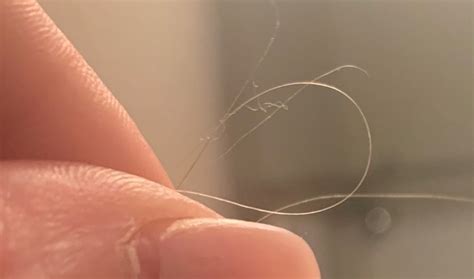 White, Hair-like Fibers Found All Over Body Causes Concern for This Reader in Northwest ...