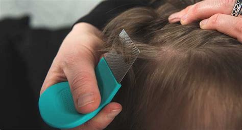 Lice Bites: How to Identify and Treat
