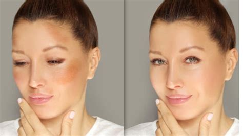 Best makeup to cover Melasma on the upper lip - ReenaSidhu