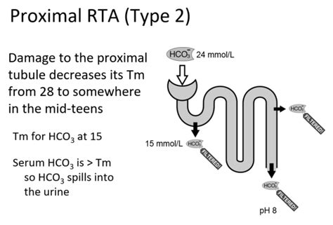 Figure-3-proximal-renal-tubular-acidosis-type-2-RTA-Joel-Topf - The Curbsiders