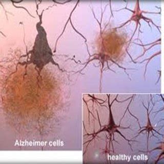 Formation of plaque in brain | Download Scientific Diagram