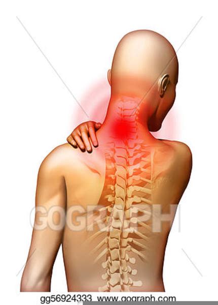 Neck Pain Clipart | Free Images at Clker.com - vector clip art online, royalty free & public domain