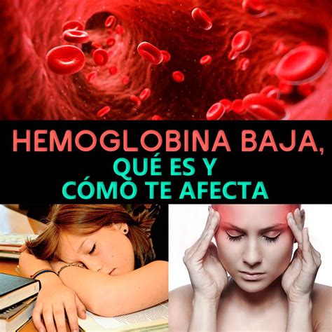 Hemoglobina baja: causas, síntomas y tratamiento - La Guía de las Vitaminas