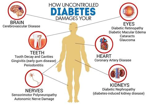 Untreated diabetes is like 'termite infestation'