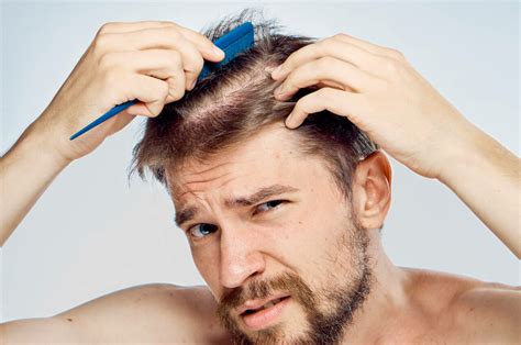 Thinning hair: why it happens and how to deal with it - myhair