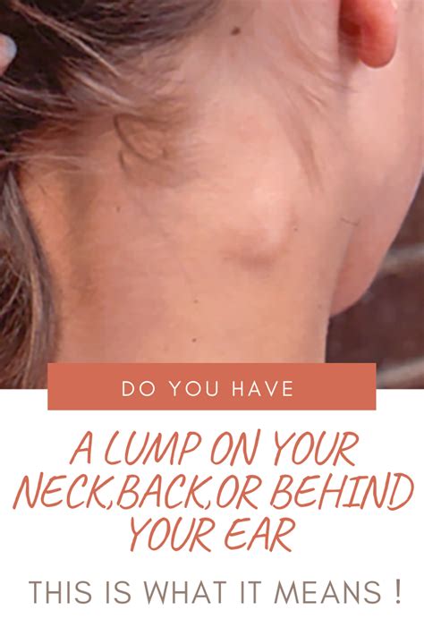 Do You Have A Lump On Your Neck Back Or Behind Your Ear Here Is What ...