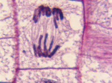 How to Identify Stages of Mitosis Within a Cell Under a Microscope | Sciencing