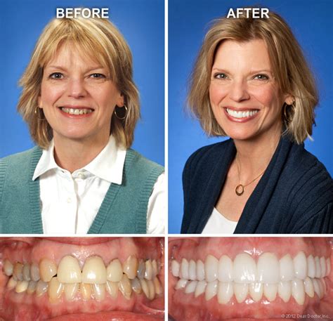 Cosmetic Dentistry | Fisher Family and Cosmetic Dentistry | Rome GA