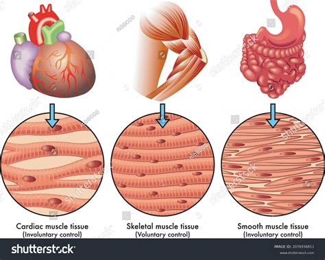 Ilustración médica de los diversos tipos: vector de stock (libre de regalías) 2076936811 ...