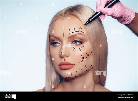 Beautiful blonde woman with markings for plastic surgery on her face Stock Photo - Alamy