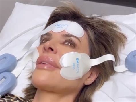 Lisa Rinna Says Her Face Is “Fresh as a Daisy” After Trying EmFace